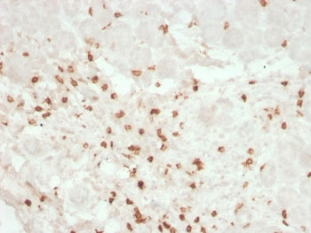 IHC testing of FFPE human colon tissue with recombinant CD8A antibody (clone rC8/468). Required HIER