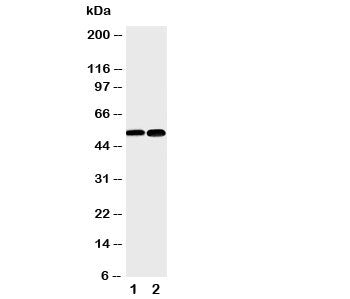 Western blot testing of NFKB2 antibody and Lane 1: mouse liver; 2: (m) HEPA cell lysate. Expected si