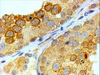 BOULE Antibody