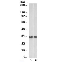 Western blot testing of human [A] and mouse [B] colon lysates with Galectin 3 antibody at 0.3ug/ml. 