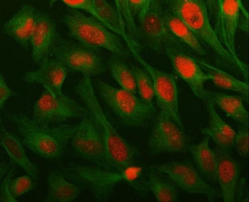 Immunofluorescent staining of FFPE human HeLa cells with ESO-3 antibody (red) and Beta Tubulin mAb (