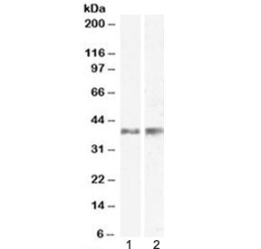 Western blot testing of 1) mouse skin and 2) rat skin lysate with Il12b antibody at 0.5ug/ml. Predic