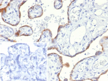 IHC staining of FFPE human placental tissue with S100A2 antibody (clone S100A2/6925). Inset: PBS use