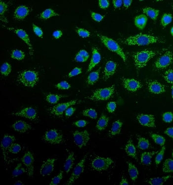 Peroxiredoxin 3 Antibody (PRDX3)