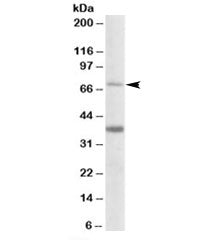 CPT2 Antibody