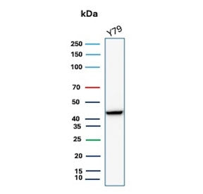 Western blot analysis of Human Brain, Mouse Brain, Rat Brain, Hamster Brain, Guinea pig Brain, Human