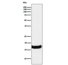 Western blot testing of human A549 cell lysate with Uteroglobin antibody. Expected molecular weight: