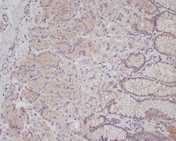 IHC staining of FFPE human stomach tissue with c-Met antibody. HIER: boil tissue sections in pH6, 10