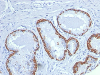 IHC staining of FFPE human prostate tissue with Keratin 14 antibody (clone KRT14/8260R). HIER: boil 