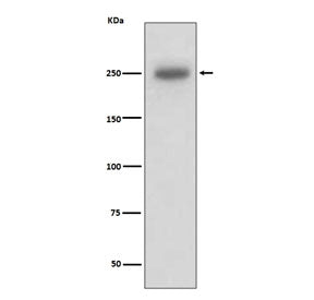Western blot testing of human A431 cell lysate with LAMB1 antibody. Predicted molecular weight ~198 