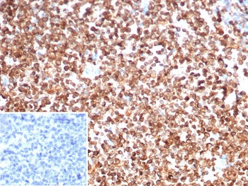 IHC staining of FFPE human spleen tissue with CD74 antibody (clone CLIP/7194) at 2ug/ml. Inset: PBS 