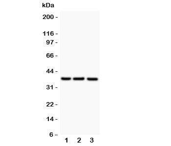 CD79b Antibody