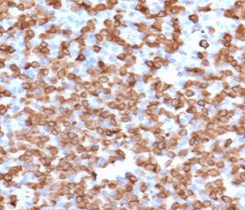 IHC staining of FFPE human spleen with CD11b antibody (clone CDLA11b-1). HIER: boil tissue sections 