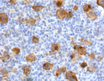 CD30 Antibody