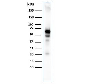 Western blot testing of human MCF7 cell lysate with recombinant AKT1 antibody. Predicted molecular w