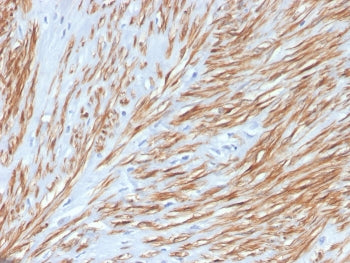 Calponin-1 Antibody
