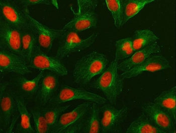 Immunofluorescent staining of FFPE human U-2 OS cells with NUMA1 antibody (red) and Beta Tubulin mAb