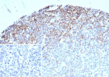 IHC staining of FFPE human tonsil tissue with CD35 antibody (clone CR1/7108) at 2ug/ml. Inset: PBS u