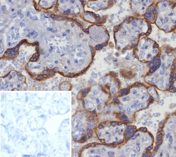 IHC staining of FFPE human placental tissue with Glypican-3 antibody (clone GPC3/8363R). Inset: PBS 