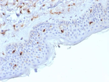 IHC staining of FFPE human skin tissue with Langerin antibody (clone LGRN/7429). HIER: boil tissue s