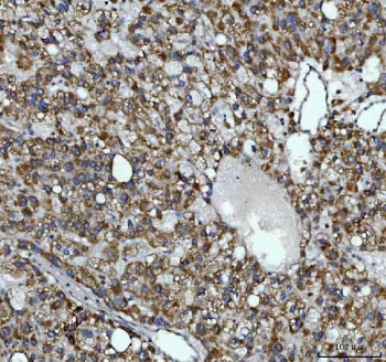 AGPS Antibody / Alkyl-DHAP synthase