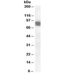 Western blot testing of mouse brain lysate with Cortactin antibody at 0.01ug/ml. Molecular weight: r