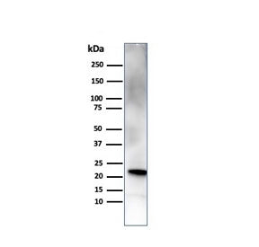 Retinol Binding Protein 4 Antibody / RBP4