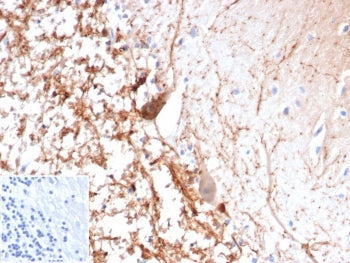 IHC staining of FFPE human brain tissue with recombinant Calretinin antibody (clone CALB2/4688R). In
