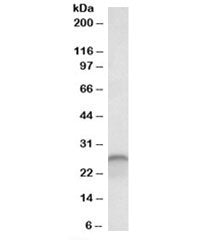 Western blot testing of human cerebellum lysate with Calbindin 1 antibody at 0.03ug/ml. Predicted mo