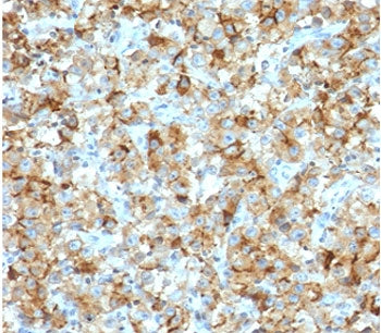 StAR Antibody / Steroidogenic acute regulatory protein