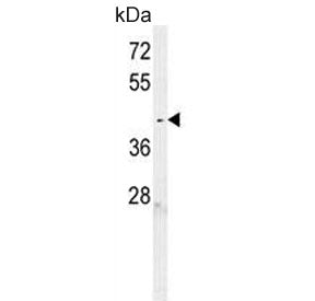 Western blot testing of human K562 cell lysate with C6orf58 antibody. Predicted molecular weight ~40