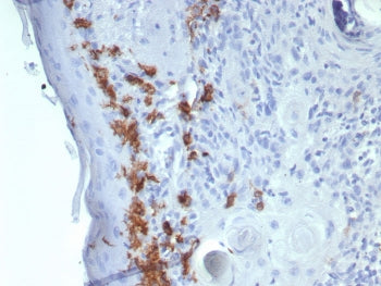IHC staining of FFPE human skin tissue with CD1a antibody (clone C1A/8111R). HIER: boil tissue secti