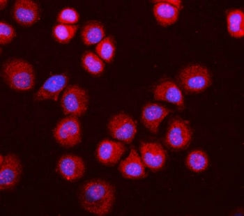 MGEA5 Antibody / OGA
