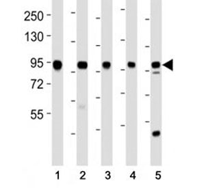 Western blot testing of EZH2 antibody at 1:2000 dilution. Lane 1: Jurkat lysate; 2: MDA-MB-231 lysat