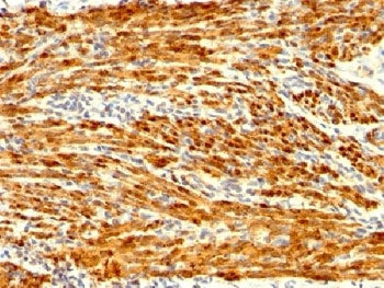 IHC testing of FFPE human uterus stained with recombinant Calponin antibody (clone CNN1/1408R). Requ