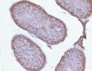 PRPF18 Antibody / Pre-mRNA-splicing factor 18