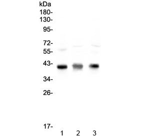 Western blot testing of 1) rat thymus, 2) mouse thymus and 3) mouse NIH 3T3 lysate with CCR4 antibod