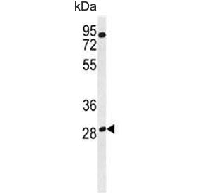 Western blot testing of human MDA-MB-435 cell lysate with RagD antibody. Predicted molecular weight: