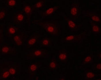 Immunofluorescent staining of FFPE human A549 cells with SNEV antibody (red). HIER: steam section in
