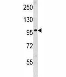 Progesterone Receptor antibody western blot analysis in human CEM lysate. Expected molecular weight: