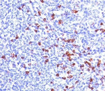 Kappa Light Chain Antibody