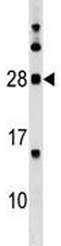 MOG antibody western blot analysis in human K562 lysate. Expected molecular weight: 15-28 kDa depend