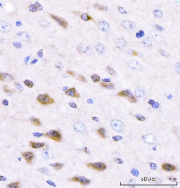 Adgrg1 Antibody / Gpr56 / Adhesion G-protein coupled receptor G1