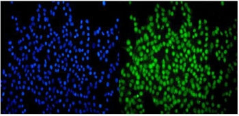 SMARCA2 Antibody / BRM