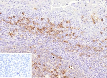 IHC staining of FFPE human tonsil tissue with ADP-ribosyl cyclase 1 antibody (clone CD38/9332). Inse