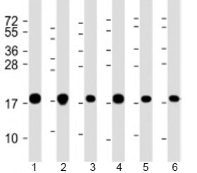 Western blot testing of human 1) A549, 2) HeLa, 3) HepG2, 4) U-2OS, 5) Jurkat and 6) placenta lysate