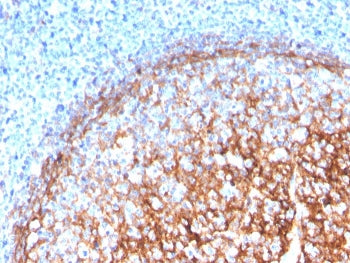 IHC staining of FFPE human tonsil with CD11b antibody (clone ITGAM/3339). HIER: boil tissue sections