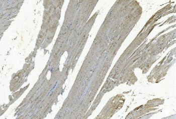 IHC staining of FFPE human skeletal muscle with GSTA4 antibody. HIER: boil tissue sections in pH8 ED
