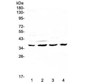 Western blot testing of human 1) HeLa, 2) SGC-7901, 3) K562 and 4) mouse SP2/0 lysate with Cdk6 anti