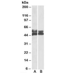 FCRL1 Antibody